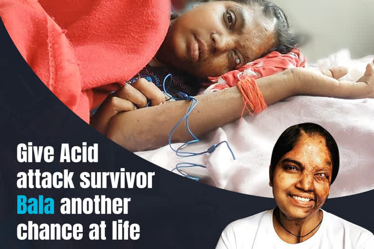 Acid attack survivor