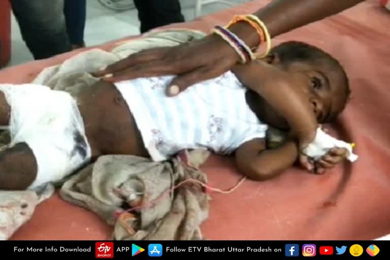 pig-severally-injured-7-month-boy-in-mahoba-referred-to-kanpur