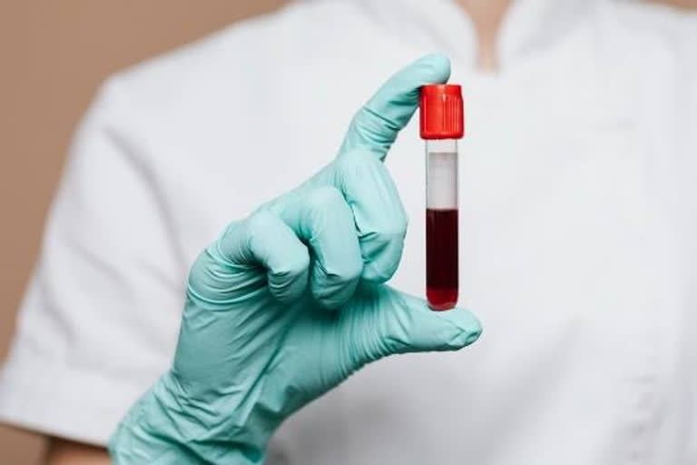 Blood sample of dengue patients sent to PGI Chandigarh