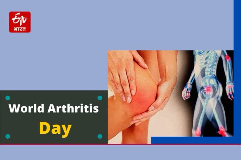 Arthritis can be treated