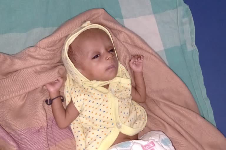 Low weight baby treated Nashik