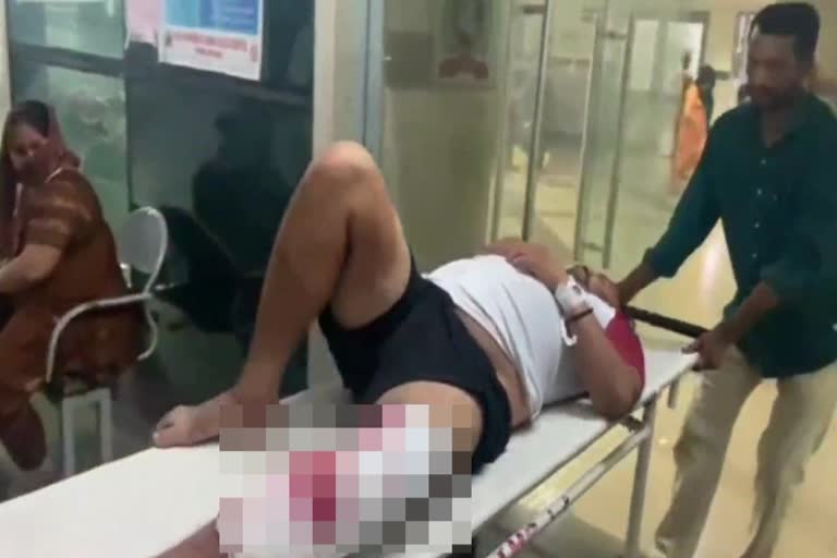 Robbers Shot Petrol Pump Employee