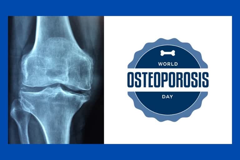 osteoporosis, osteoporosis day, world osteoporosis day, what is osteoporosis, what are the symptoms of osteoporosis, what is the treatment for osteoporosis, bone health, bone health tips, how to keep bone healthy, disease, bone disease,  calcium, why is bone health important, what are the causes of osteoporosis, who is at risk of osteoporosis