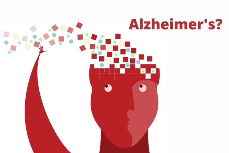 memory loss, Alzheimer's Disease, Alzheimer, Alzheimers, dementia, what is alzheimer's, what are the causes of alzheimers, who is at risk of alzheimers, who can have alzheimers, what is dementia, what is the treatment for dementia, what is the treatment for alzheimers, who is at risk of dementia, is there a cure for alzheimers, what are the symptoms of alzheimers, health, neurological disorders, neurological health