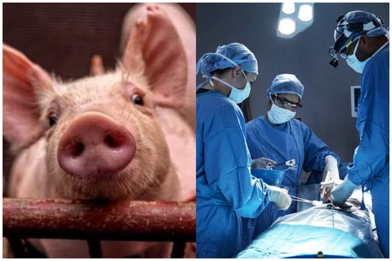 World's First Pig Kidney Transplant Into Human