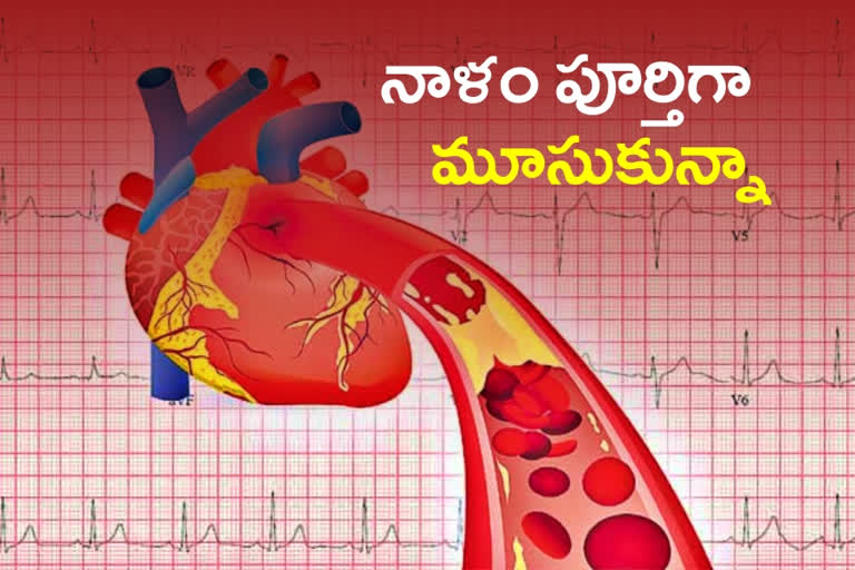 Blood supply to Heart