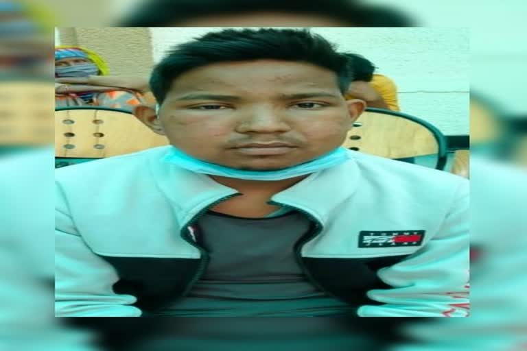 Mayank kidney transplant