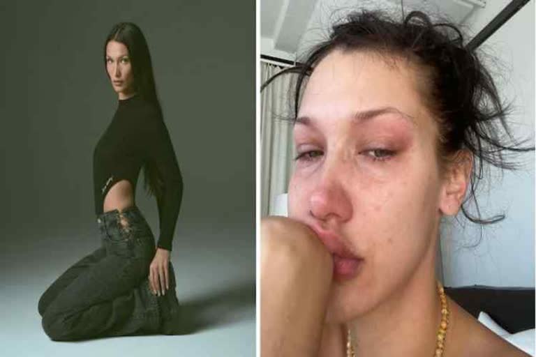 bella hadid shares crying selfies talks about her mental health struggles in viral insta post