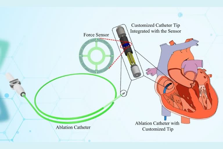 Minimally Invasive Surgery, minimally invasive surgery spine, laparoscopic surgery, laser surgery piles, surgical laser veterinary, advantages of lasers, benefits of laser surgery, MIS, what is MIS, what is Minimally Invasive Surgery, how is Minimally Invasive Surgery done,  Vibro-haptic feedback,   Catheter Contact Force Measurement, Indian Institute of Science Bangalore