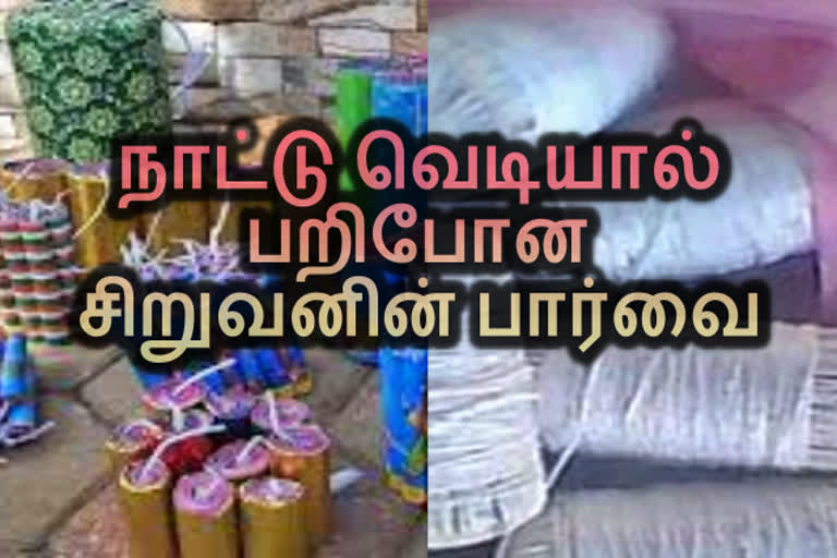 country bomb  crackers  sight of a boy snatched by a country bomb  chennai cracker issue  cracker issue  chennai news  chennai latest news  சென்னை செய்திகள்  அண்மை செய்திகள்  நாட்டு வெடி  சென்னையில் நாட்டு வெடியால் பறிபோன சிறுவனின் பார்வை  நாட்டு வெடியால் பறிபோன சிறுவனின் பார்வை