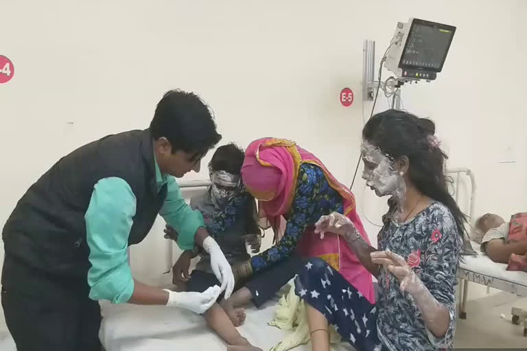 चूरू में पटाखा फटा, बच्चे झुलसे