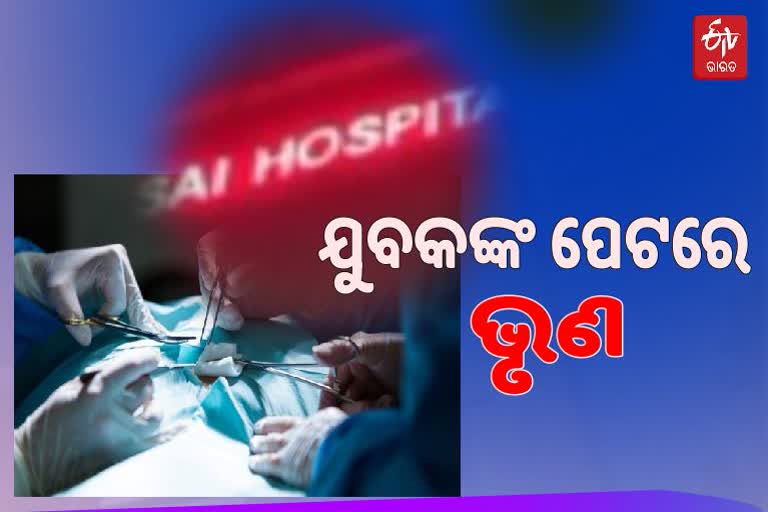 Rare Operation: ବାରିପଦାରେ ବିରଳ ଅସ୍ତ୍ରୋପଚାର, ଯୁବକଙ୍କ ପେଟରୁ ବାହାରିଲା ଦାନ୍ତ ଓ ଚୁଟି ମିଶା ମାଂସପିଣ୍ଡୁଳା