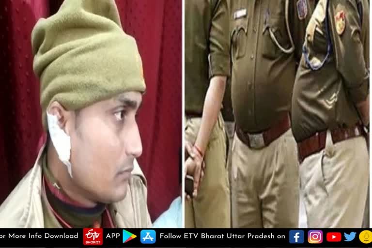 दबंग ने काट लिया पुलिसकर्मी का कान