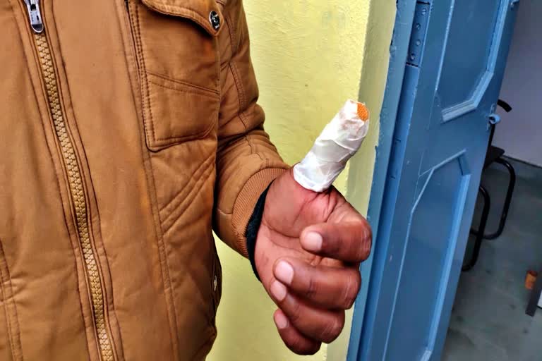 HIV infected prisoner chewed the thumb
