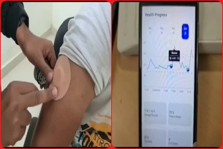 Engineering students develop device to monitor blood-sugar levels real-time