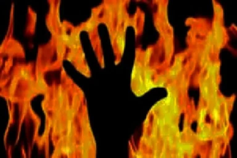 Teenager burnt alive