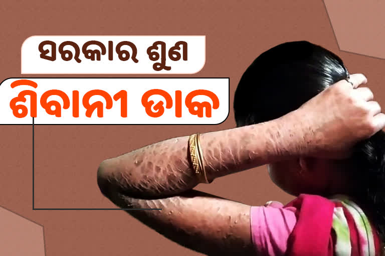 ଜୀବନ ଅଭିଶପ୍ତ କରିଦେଇଛି ରୋଗ, ଚିକିତ୍ସା ପାଇଁ ସହାୟତା ଲୋଡା