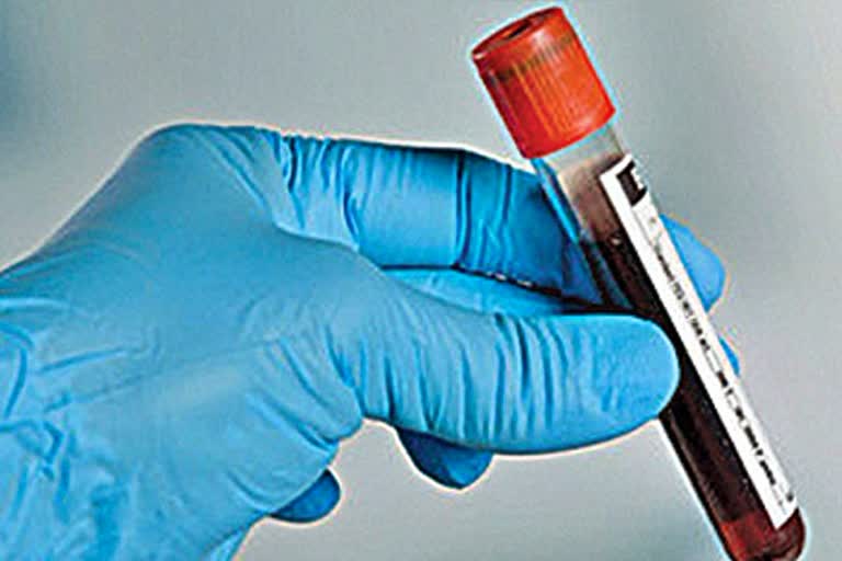 Blood Test for Depression