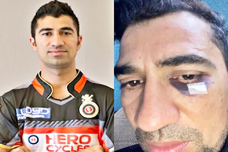 Vikas Tokas  Delhi Police News  RCB  Hindi Cricket News  Cricket News In Hindi  Sports News  आईपीएल  ​रॉयल चैलेंजर्स बेंगलोर  Delhi Police  player assaulted  विकास टोकस के साथ दुर्व्यवहार  विकास टोकस के साथ मारपीट  दिल्ली पुलिस