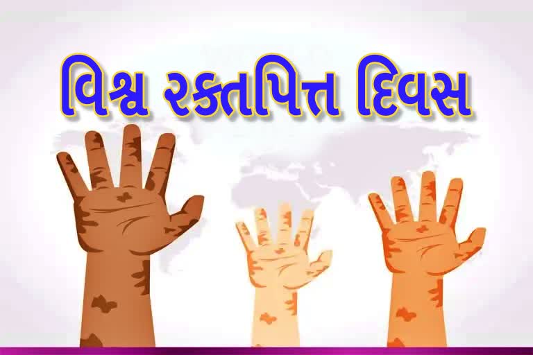 World Leprosy Day 2022 :શું આ રોગ અડવાથી પણ ફેલાય છે ? જાણો શું છે તથ્ય...