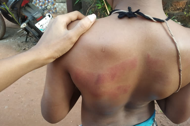 Teacher beat to student in Karwar, Teacher sorry ask to student in Karwar, Karwar news, Uttara Kannada news, ಕಾರವಾದಲ್ಲಿ ವಿದ್ಯಾರ್ಥಿ ಮೇಲೆ ಶಿಕ್ಷಕಿ ದರ್ಪ, ಕಾರವಾದಲ್ಲಿ ವಿದ್ಯಾರ್ಥಿಗೆ ಕ್ಷಮೆ ಕೇಳಿದ ಶಿಕ್ಷಕಿ, ಬಾಸುಂಡೆ ಬರುವ ರಿತಿ ಹೊಡೆದು ಕ್ಷಮೆ ಕೇಳಿದ ಶಿಕ್ಷಕಿ, ಕಾರವಾರ ಸುದ್ದಿ,