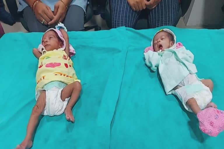 Surat New Born Baby defeat Corona: સુરતમાં નવજાત કોરોનાગ્રસ્ત જોડીયા બાળકીઓએ 20 દિવસમાં કોરોનાને હરાવ્યો, જુઓ