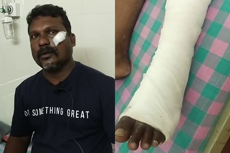 Ernakulam Vadattupara wild boar attack  എറണാകുളം കാട്ടുപന്നി ആക്രമണം കേബിൾ ടിവി ടെക്‌നീഷ്യനു പരിക്ക്  വടാട്ടുപാറ കാട്ടുപന്നി വണ്ടിയ്‌ക്ക് വട്ടംചാടി