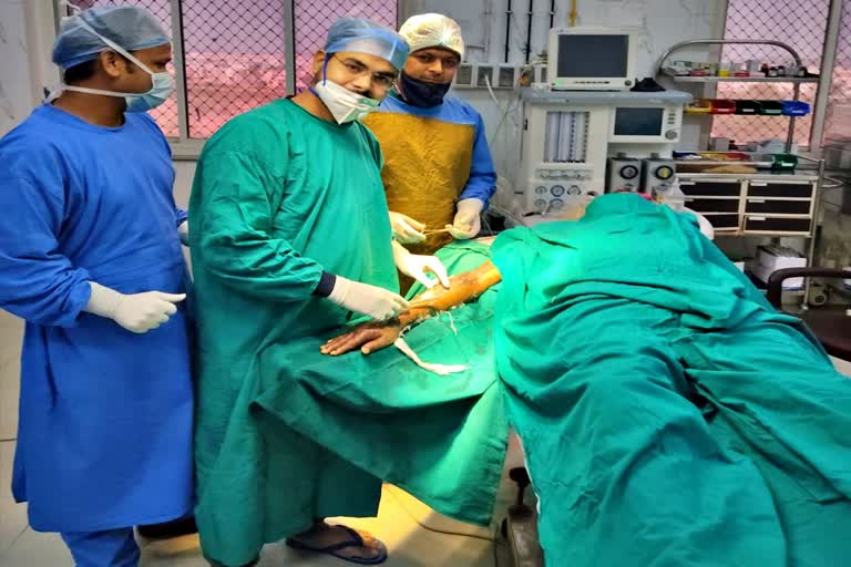 Plastic surgery in RBM Hospital Bharatpur