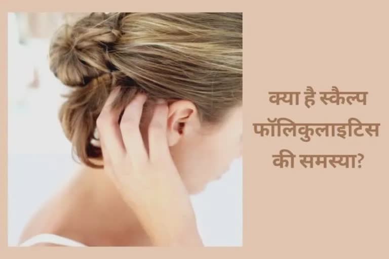 Problem of Folliculitis : મસ્તિષ્ક ત્વચાની આ ગંભીર સમસ્યાથી કઇ રીતે બચી શકાય? નિષ્ણાત પાસે જાણો