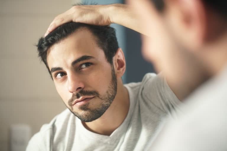 What causes hair loss or baldness in young men, hair loss in men, hair care tips for men, causes of baldness in men, male hair loss