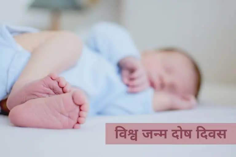 World Birth Defects Day: નવજાત બાળકની આ ખાસ વાત વિશે દરેક માં-બાપે જાણવું