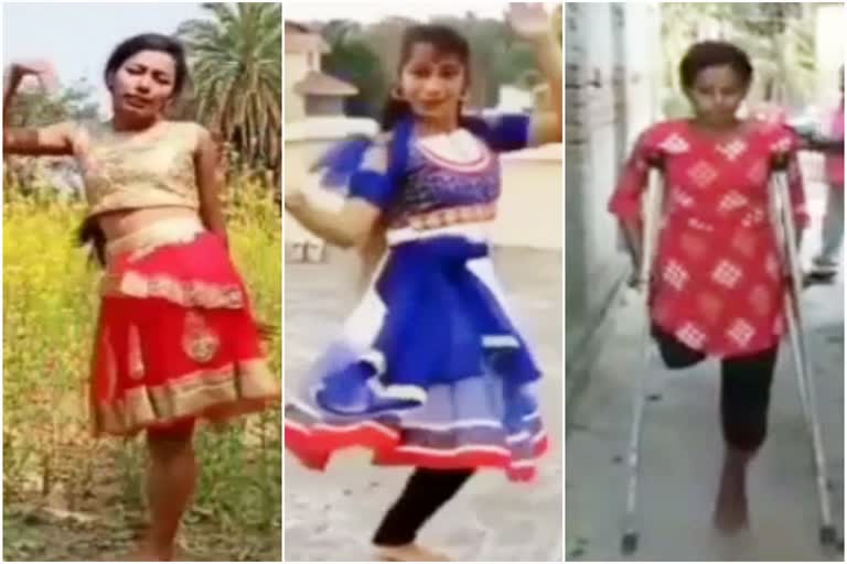 one leg dancer Rekha Mishra became a sensation in dhanbad