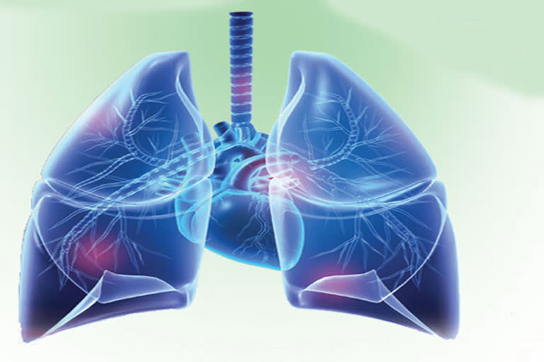 Robotic Surgery for Lung Cancer