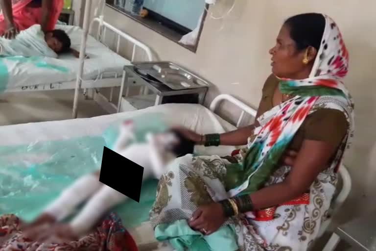 Two Girl Burnt In Nashik