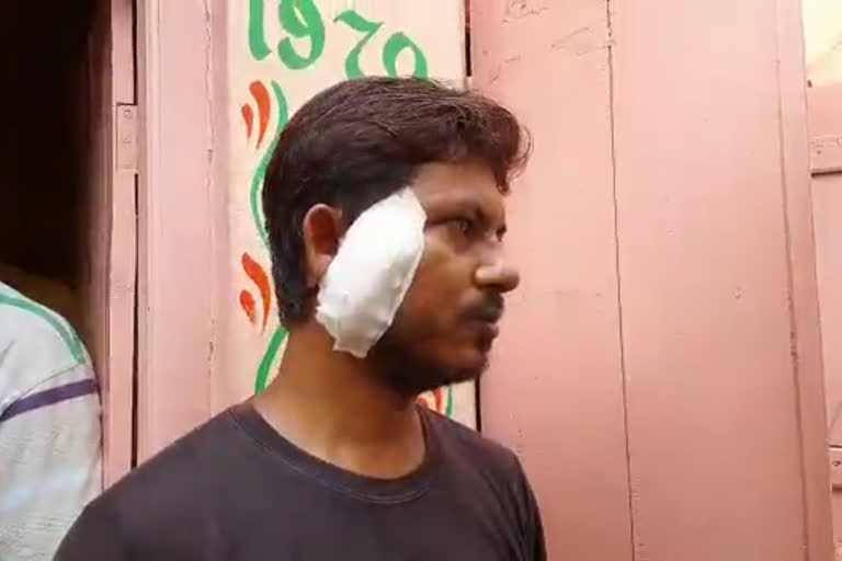 Businessman Attack By Criminal