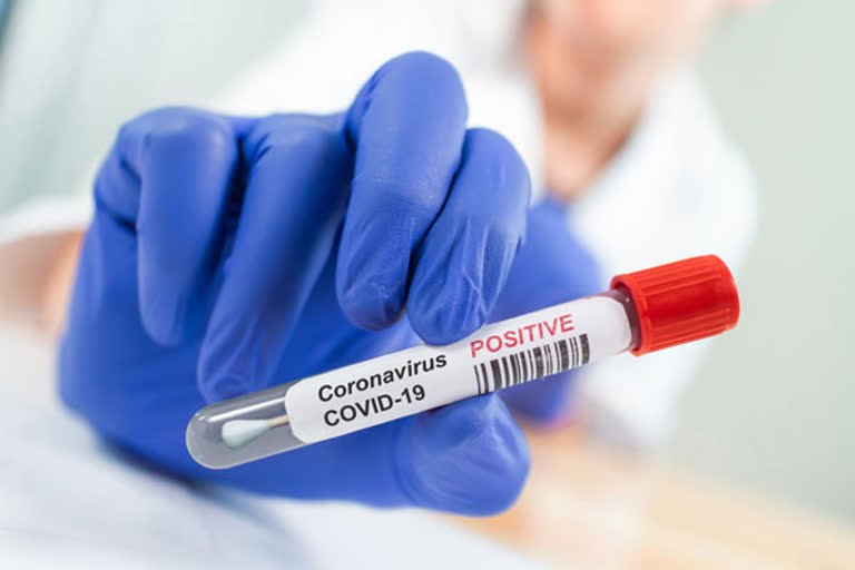 longest coronavirus positive