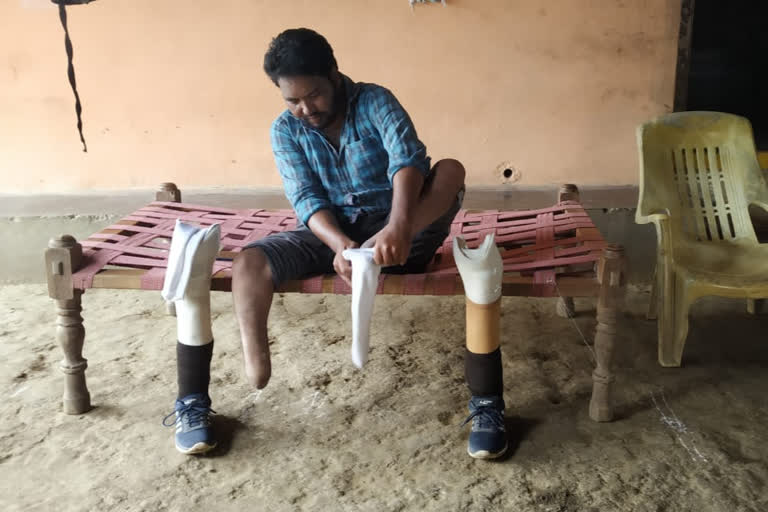 Telangana man gets new lease of life with artificial legs