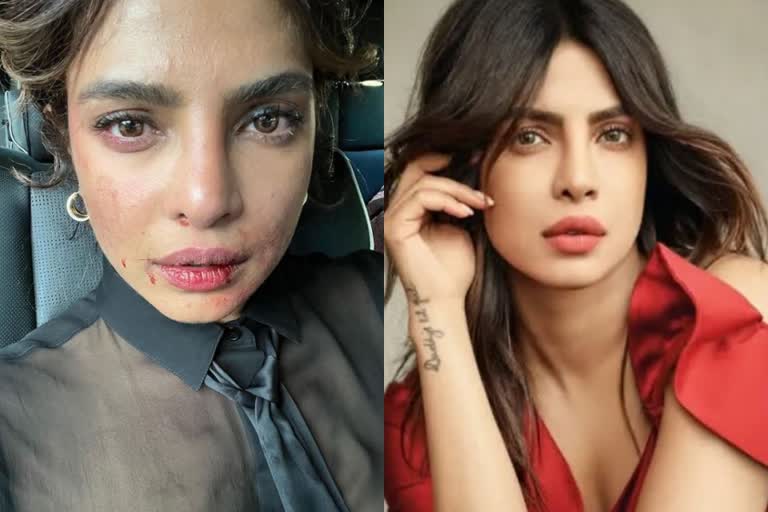 priyanka chopra latest picture  priyanka chopra selfie citadel location  priyanka chopra actress  priyanka chopra latest news  പ്രിയങ്ക ചോപ്ര പരിക്ക്  പ്രിയങ്ക ചോപ്ര ചിത്രം  പ്രിയങ്ക ചോപ്ര സെല്‍ഫി  പ്രിയങ്ക ചോപ്ര നടി