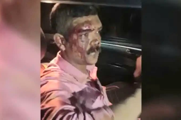 #pta attack  police officer attacked by young men pathanamthitta  ഗതാഗത തടസമുണ്ടാക്കി ലോറിയില്‍ തടി കയറ്റി പ്രശ്‌നം പരിഹരിക്കാനെത്തിയ പൊലീസുകാരന് ക്രൂര മര്‍ദനം  pathanamthitta crime news  lorry drivers attacked police officer in pathanamthitta  പെരുനാട് സ്റ്റേഷനിലെ സീനിയര്‍ സിവില്‍ പൊലീസ് ഓഫീസര്‍ അനില്‍ കുമാറിനാണ് മർദനമേറ്റത്