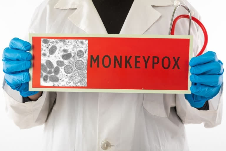 Monkeypox primarily spread via sexual contact, but containable: