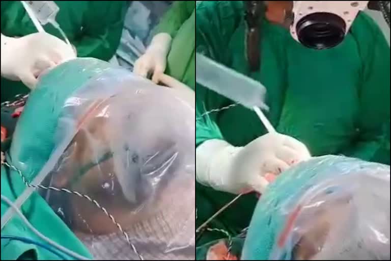 What if my brain is opened up  let me sing a song; video of a live surgery goes viral  തലച്ചോര്‍ ശസ്‌ത്രക്രിയയ്‌ക്കിടെ രോഗിയുടെ പാട്ട് വൈറല്‍  തലച്ചേര്‍ ശസ്‌ത്രക്രിയയ്‌ക്കിടെ ഗുലാം അലിയുടെ ഹംഗാമ ക്യോൻ ബാപ്ര രഹേ ഹോ പാട്ട് പാടി രോഗി  viral song of patient during brain surgery in rayipur