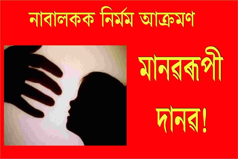 অমানৱীয়! নাবালকক ফেনত ওলোটাই গৰম লোৰ ৰ'ডেৰে প্ৰহাৰ, মুখ্য অভিযুক্তক আটক