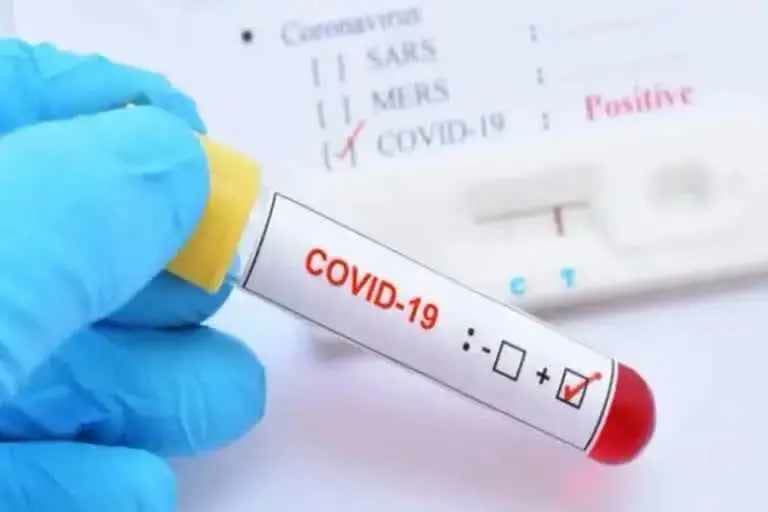 India sees 12  899 fresh COVID-19 cases  128899 new covid positive cases reported in india  covid 19  കൊവിഡ് 19  കഴിഞ്ഞ 24 മണിക്കൂറില്‍ രാജ്യത്ത് 12899 കേസുകള്‍ റിപ്പോര്‍ട്ട് ചെയ്‌തു  ഇന്ത്യയിലെ കൊവിഡ് കേസുകള്‍