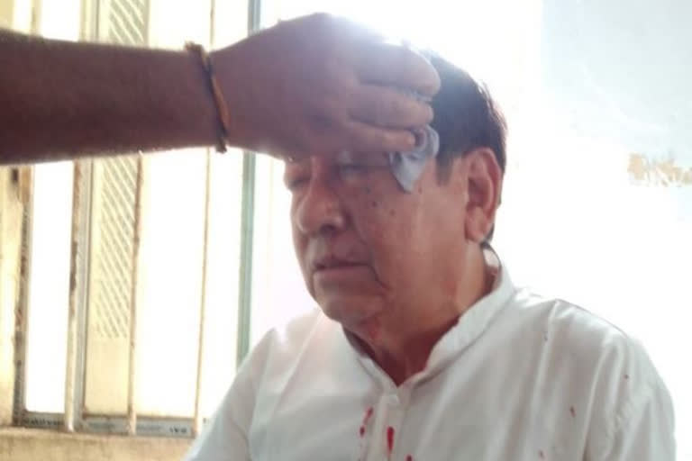 congress president Birajit Sinha being attacked in Agartala after Tripura By poll Result