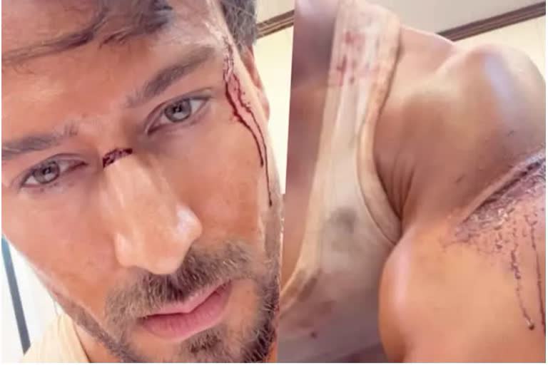 tiger shroff injured  tiger shroff injury on set  tiger shroff injured during ganapath shoot  tiger shroff latest news  ടൈഗര്‍ ഷ്‌റോഫ്  ടൈഗര്‍ ഷ്‌റോഫിന് പരിക്ക്  ഗണപത് സിനിമ  ടൈഗര്‍ ഷ്‌റോഫ് വീഡിയോ  ഗണപത് പാര്‍ട്ട് വണ്‍  ടൈഗര്‍ ഷ്‌റോഫ് ഇന്‍സ്റ്റഗ്രാം