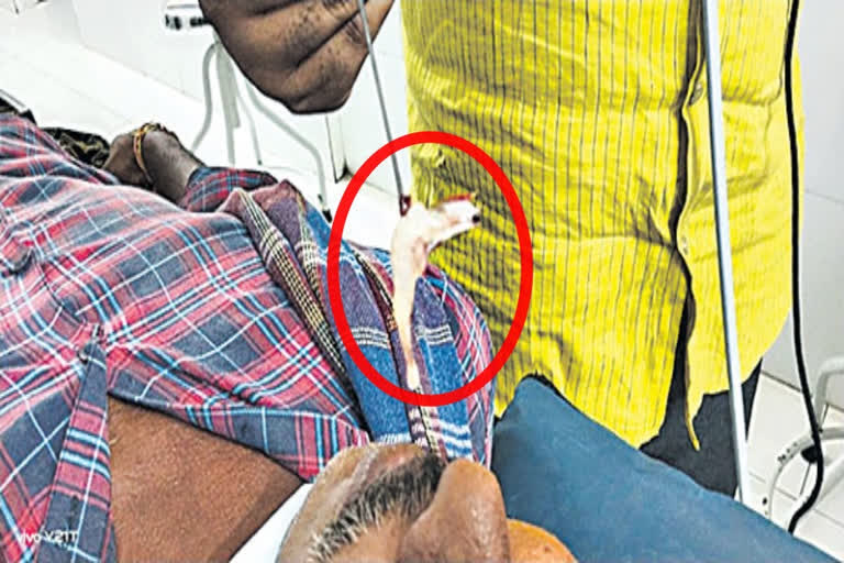 Shrimp entered in the nose of man at eluru