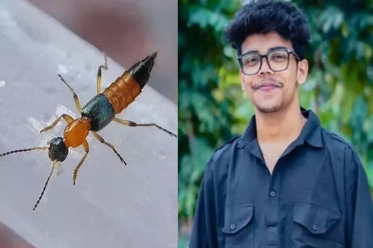 ashoknagar-youth-attacked-by-nairobi-fly