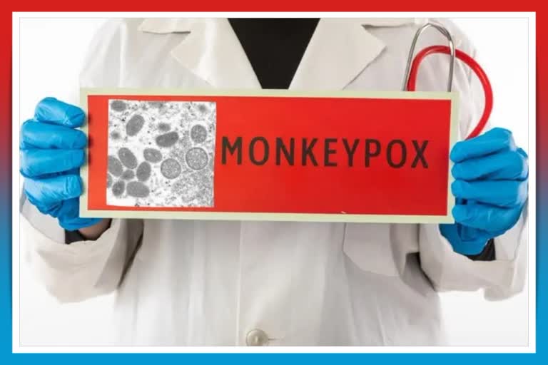 Monkeypox:ગુજરાત આરોગ્ય વિભાગ એલર્ટ, કેસ આવશે તો દર્દી માટે અલગ વ્યવસ્થા થશે