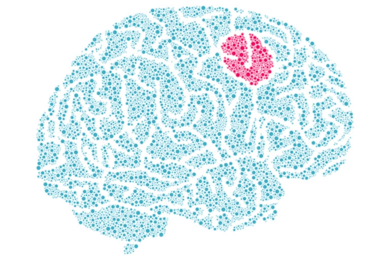 Impact of brain tumour on quality of life, how brain tumour affects health, what is brain tumour, Behavioural changes caused by brain tumours