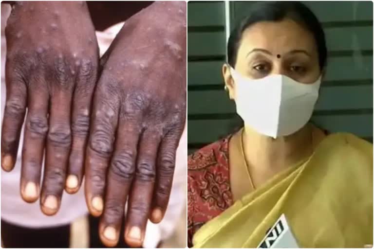 Health department of kerala conducted official Meeting due to monkeypox and other epidemics  Meeting conducted by Health department of kerala  monkeypox and other epidemics in Kerala  health minister gave advices on behalf of monkeypox and other epidemics  സംസ്ഥാനത്ത് മങ്കിപോക്‌സും പകര്‍ച്ചവ്യാധികളും  സംസ്ഥാനത്ത് മങ്കിപോക്‌സും പകര്‍ച്ചവ്യാധികളും റിപ്പോര്‍ട്ട് ചെയ്‌ത സാഹചര്യത്തില്‍ ഉന്നതതല യോഗം ചേര്‍ന്ന് ആരോഗ്യ വകുപ്പ്  ആരോഗ്യ വകുപ്പിന്‍റെ ഉന്നതതല യോഗം